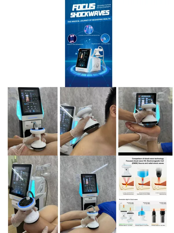 첨단 의료용 충격파 치료 장치는 운동선수들의 근육 회복 - Tech Accessories Uk 리뷰 및 가격